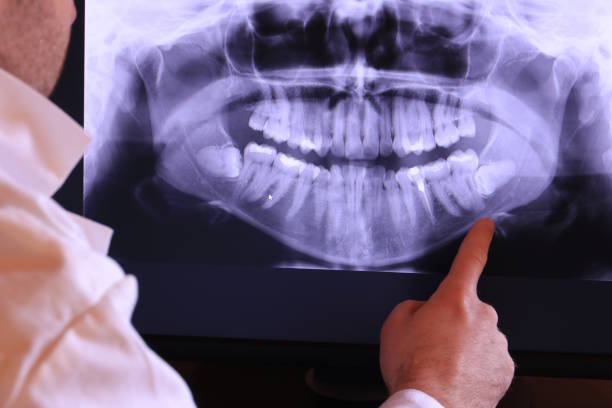 Best Emergency Dental Care for Abscessed Tooth in Malvern, AR
