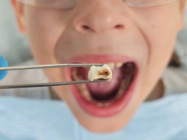 Best Mobile Emergency Dentist in Malvern, AR