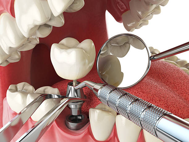 Best Orthodontic Emergency Dentist in Malvern, AR